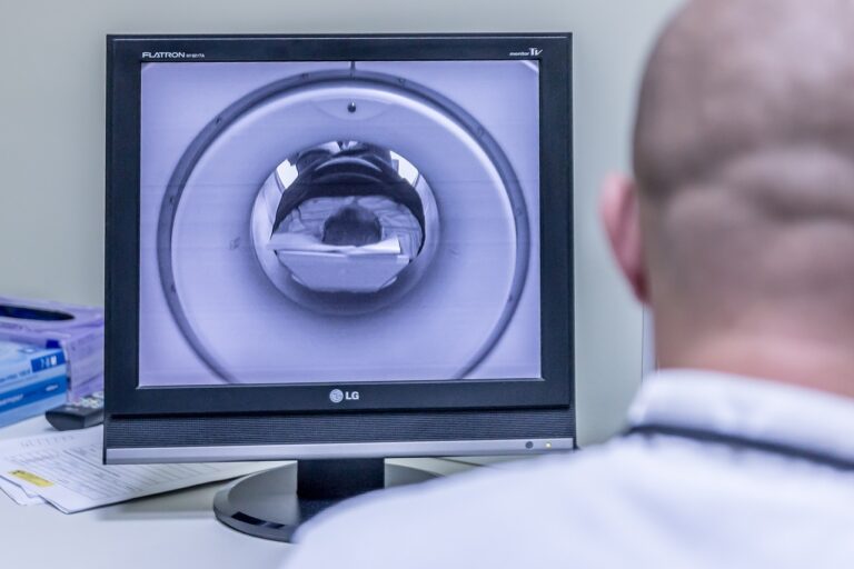 Operatie of MRI? Nieuw onderzoek om stadium van blaaskanker te bepalen