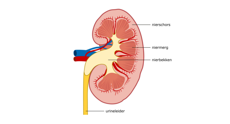 Losgeraakte tumorcellen vaak de oorzaak van blaaskanker na tumor in de hoge urinewegen